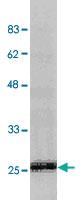 Anti-CRADD Rabbit Polyclonal Antibody