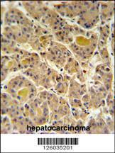 Anti-IN80D Rabbit Polyclonal Antibody (HRP (Horseradish Peroxidase))