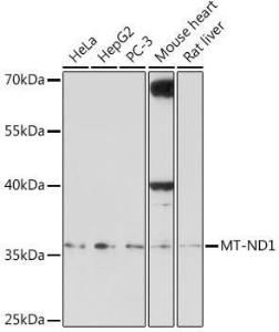 Anti-MT-ND1 Rabbit Polyclonal Antibody