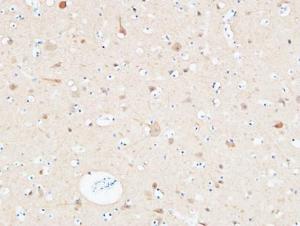 Immunohistochemical analysis of paraffin-embedded human Cerebral cortex using Anti-UCHL1 Antibody