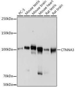 Western blot analysis of extracts of various cell lines, using Anti-CTNNA3 Antibody [ARC2463] (A305581) at 1:1,000 dilution