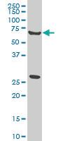 Anti-WASF2 Mouse Monoclonal Antibody [clone: 1F7]