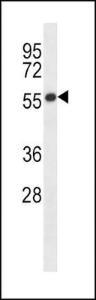 Anti-GABRB2 Rabbit Polyclonal Antibody (Biotin)