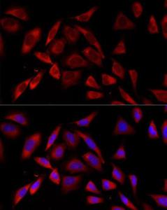 Immunofluorescence analysis of HeLa using Anti-PKC alpha Antibody [ARC58845] (A309443) at a dilution of 1:100 (40X lens). DAPI was used to stain the cell nuclei (blue)