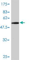 Anti-TNNT1 Mouse Polyclonal Antibody