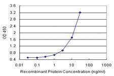 Anti-CPB1 Polyclonal Antibody Pair