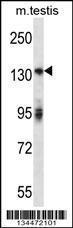 Anti-ERBB2 Rabbit Polyclonal Antibody (APC (Allophycocyanin))