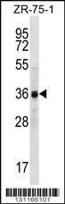 Anti-CCNYL2 Rabbit Polyclonal Antibody (APC (Allophycocyanin))