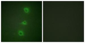 Immunofluorescence analysis of HUVEC cells using Anti-B-RAF Antibody. The right hand panel represents a negative control, where the antibody was pre-incubated with the immunising peptide