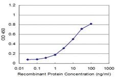 Anti-WASF2 Mouse Monoclonal Antibody [clone: 1F7]