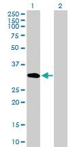 Anti-SUN1 Mouse Polyclonal Antibody