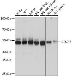 Anti-Cdc37 Rabbit Monoclonal Antibody [clone: ARC1040]