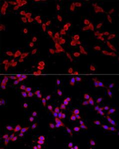 Immunofluorescence analysis of NIH/3T3 using Anti-PKC alpha Antibody [ARC58845] (A309443) at a dilution of 1:100 (40X lens). DAPI was used to stain the cell nuclei (blue)