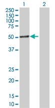 Anti-IL1RAP Rabbit Polyclonal Antibody