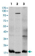 Anti-UBE2I Mouse Monoclonal Antibody [clone: 1B10]