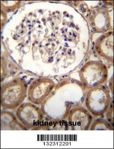 Anti-CLEC18A Rabbit Polyclonal Antibody (FITC (Fluorescein Isothiocyanate))