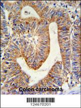 Anti-RPL17 Rabbit Polyclonal Antibody (PE (Phycoerythrin))