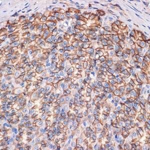 Immunohistochemistry analysis of paraffin-embedded rat stomach using Anti-CTNNA3 Antibody [ARC2463] (A305581) at a dilution of 1:100 (40X lens). Perform microwave antigen retrieval with 10 mM Tris/EDTA buffer pH 9.0 before commencing with IHC staining protocol