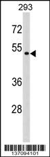 Anti-P2RX6 Rabbit Polyclonal Antibody