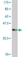 Anti-PKP3 Mouse Polyclonal Antibody