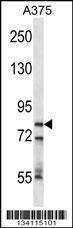 Anti-CPSF3 Rabbit Polyclonal Antibody (AP (Alkaline Phosphatase))