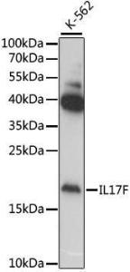 Western blot analysis of extracts of various cell lines, using Anti-IL-17F Antibody (A11979) at 1:1000 dilution. The secondary Antibody was Goat Anti-Rabbit IgG H&L Antibody (HRP) at 1:10000 dilution. Lysates/proteins were present at 25 µg per lane