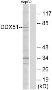 Western blot analysis of lysates from HepG2 cells using Anti-DDX51 Antibody. The right hand lane represents a negative control, where the antibody is blocked by the immunising peptide