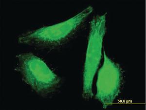 Anti-SUN1 Mouse Polyclonal Antibody