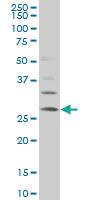 Anti-DKK1 Mouse Monoclonal Antibody [clone: 3G3]