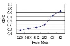 Anti-GGT1 Antibody Pair