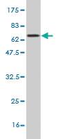 Anti-CPB1 Mouse Monoclonal Antibody [clone: 4D5]