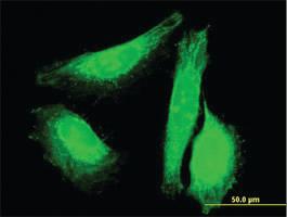 Anti-SUN1 Mouse Polyclonal Antibody