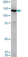 Anti-UNC13D Mouse Monoclonal Antibody [clone: 2C7]