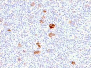 Immunohistochemical analysis of formalin-fixed, paraffin-embedded Hodgkin's lymphoma using Anti-Bcl-X Antibody [BCL2L1/2406]