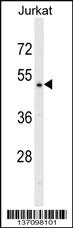 Anti-DNAJA2 Rabbit Polyclonal Antibody