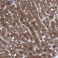 Anti-VPS37D Rabbit Polyclonal Antibody