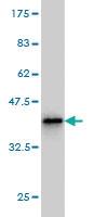 Anti-PTX3 Mouse Monoclonal Antibody [clone: 2B10]