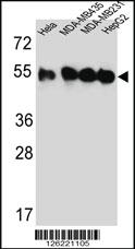 Anti-TUBB4B Rabbit Polyclonal Antibody