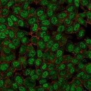 Immunofluorescent analysis of PFA fixed HeLa cells stained with Anti-ZMYM3 Antibody [PCRP-ZMYM3-2F10] followed by Goat Anti-Mouse IgG (CF&#174; 488) (Green). Counterstain is Phalloidin-CF&#174; 640A (Red).