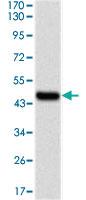 Anti-UBE2I Mouse Monoclonal Antibody [clone: 1B10]