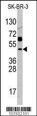 Anti-TP53 Rabbit Polyclonal Antibody (HRP (Horseradish Peroxidase))