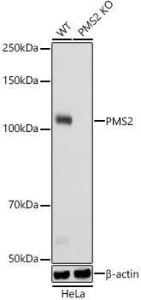 Anti-PMS2 Rabbit Monoclonal Antibody [clone: ARC2479]