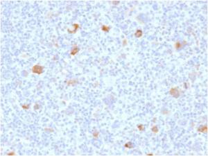 Immunohistochemical analysis of formalin-fixed, paraffin-embedded Hodgkin's lymphoma using Anti-Bcl-X Antibody [BCL2L1/2406]