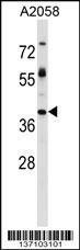 Anti-TPBG Rabbit Polyclonal Antibody