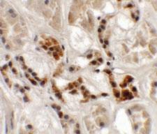 Anti-AP3S1 Rabbit Polyclonal Antibody