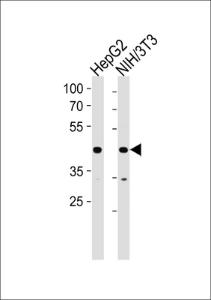 Anti-NR2F2 Rabbit Polyclonal Antibody