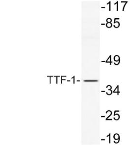 Western blot analysis of lysate from NIH/3T3 cells using Anti-TTF-1 Antibody