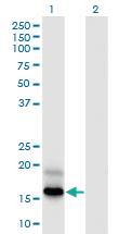 Anti-PFDN4 Mouse Monoclonal Antibody [clone: 2G4]