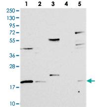 Anti-RMI2 Rabbit Polyclonal Antibody