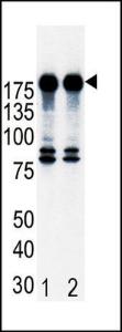 Anti-ERBB2 Rabbit Polyclonal Antibody